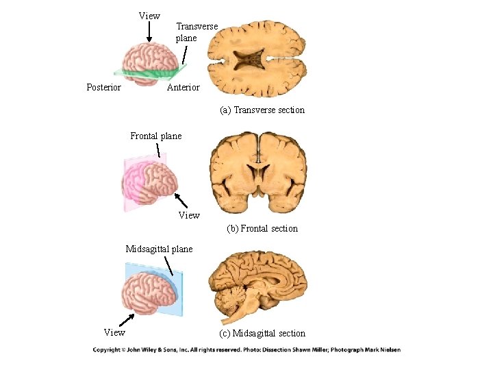 View Posterior Transverse plane Anterior (a) Transverse section Frontal plane View (b) Frontal section View Posterior Transverse plane Anterior (a) Transverse section Frontal plane View (b) Frontal section
