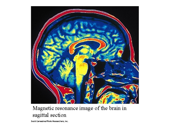 Magnetic resonance image of the brain in sagittal section Magnetic resonance image of the brain in sagittal section