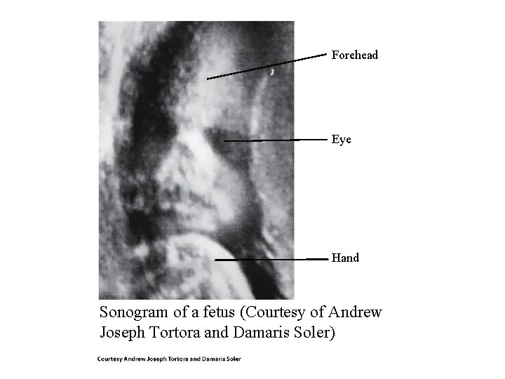 Forehead Eye Hand Sonogram of a fetus (Courtesy of Andrew Joseph Tortora and Damaris Forehead Eye Hand Sonogram of a fetus (Courtesy of Andrew Joseph Tortora and Damaris