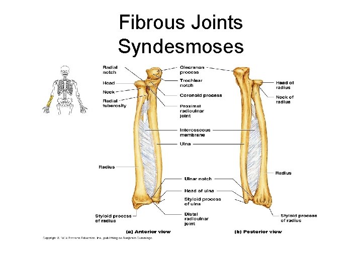 Fibrous Joints Syndesmoses 