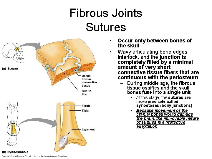 Fibrous Joints Sutures • • Occur only between bones of the skull Wavy articulating