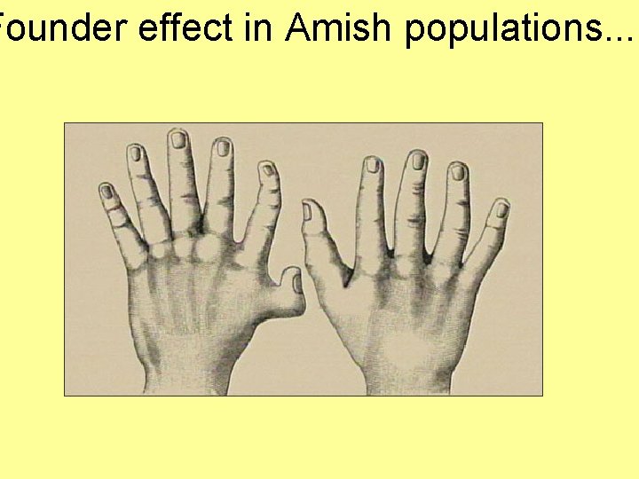 Founder effect in Amish populations. . . 
