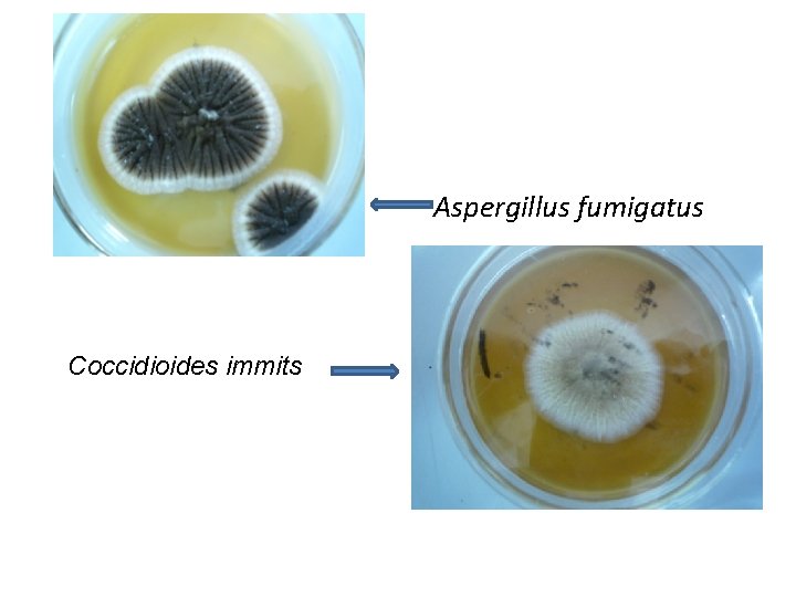 Aspergillus fumigatus Coccidioides immits 