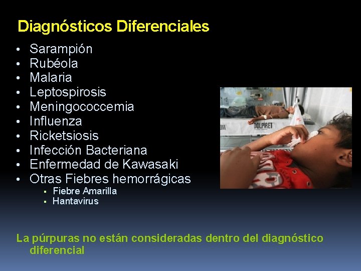 Diagnósticos Diferenciales • • • Sarampión Rubéola Malaria Leptospirosis Meningococcemia Influenza Ricketsiosis Infección Bacteriana Diagnósticos Diferenciales • • • Sarampión Rubéola Malaria Leptospirosis Meningococcemia Influenza Ricketsiosis Infección Bacteriana