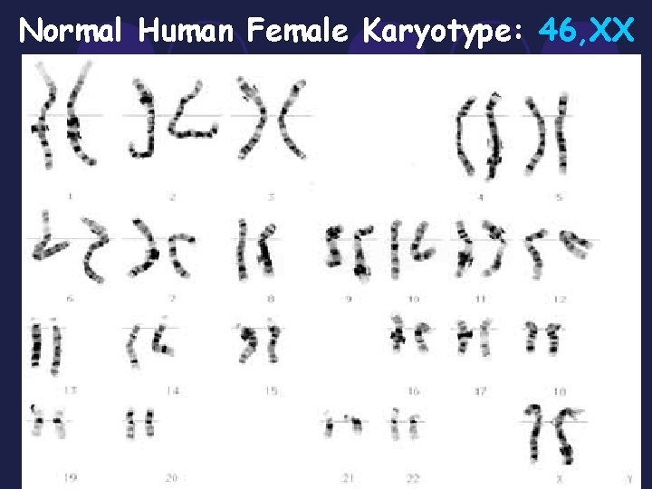 Normal Human Female Karyotype: 46, XX 