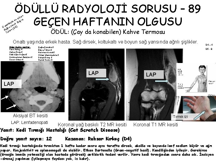 ÖDÜLLÜ RADYOLOJİ SORUSU – 89 GEÇEN HAFTANIN OLGUSU n rke n e şra e