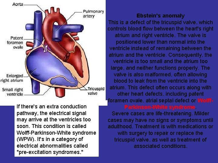 If there's an extra conduction pathway, the electrical signal may arrive at the ventricles