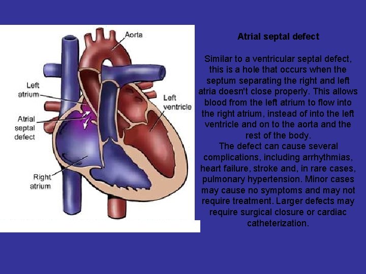 Atrial septal defect Similar to a ventricular septal defect, this is a hole that