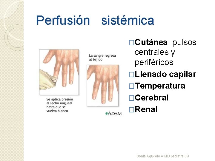Perfusión sistémica �Cutánea: pulsos centrales y periféricos �Llenado capilar �Temperatura �Cerebral �Renal Sonia Agudelo