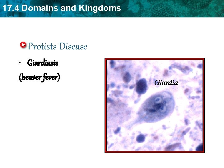 17. 4 Domains and Kingdoms Protists Disease • Giardiasis (beaver fever) Giardia 