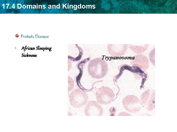 17. 4 Domains and Kingdoms Protists Disease • African Sleeping Sickness Trypanosoma 