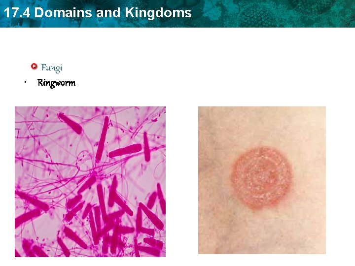 17. 4 Domains and Kingdoms Fungi • Ringworm 