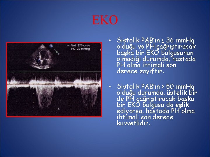EKO • Sistolik PAB’ın ≤ 36 mm. Hg olduğu ve PH çağrıştıracak başka bir EKO • Sistolik PAB’ın ≤ 36 mm. Hg olduğu ve PH çağrıştıracak başka bir