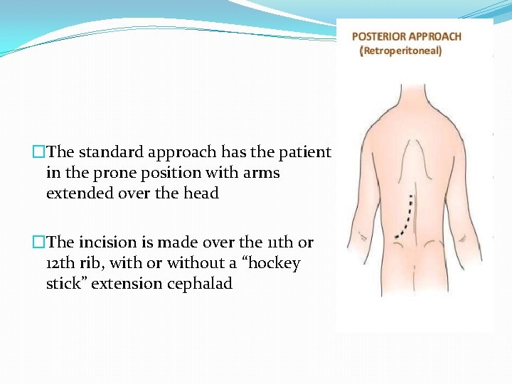�The standard approach has the patient in the prone position with arms extended over