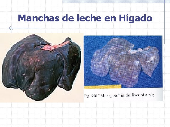 Manchas de leche en Hígado 