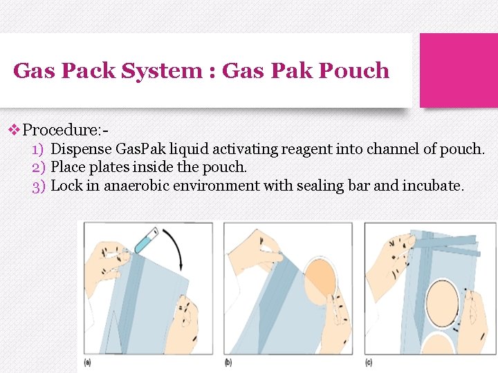 Gas Pack System : Gas Pak Pouch v. Procedure: 1) Dispense Gas. Pak liquid