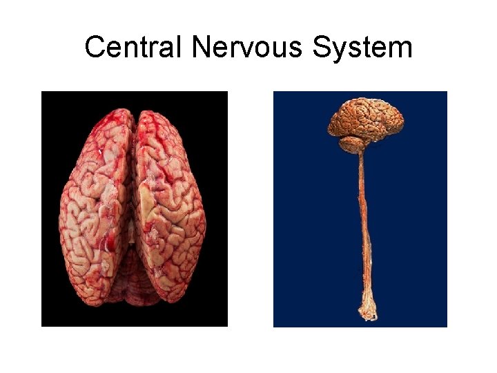 Central Nervous System Central Nervous System