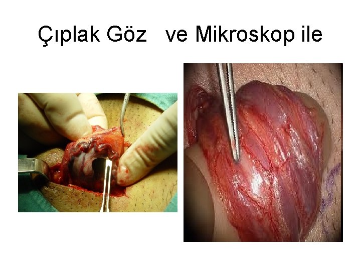 Çıplak Göz ve Mikroskop ile 