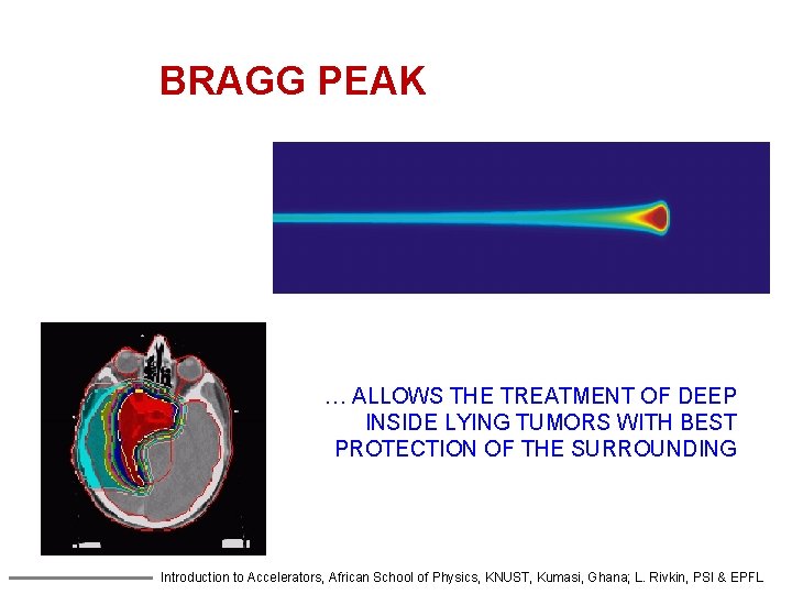 BRAGG PEAK PROTO N BEAM … ALLOWS THE TREATMENT OF DEEP INSIDE LYING TUMORS