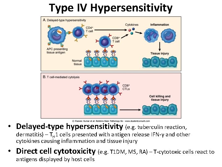 Type IV Hypersensitivity • Delayed-type hypersensitivity (e. g. tuberculin reaction, dermatitis) – TH 1 Type IV Hypersensitivity • Delayed-type hypersensitivity (e. g. tuberculin reaction, dermatitis) – TH 1