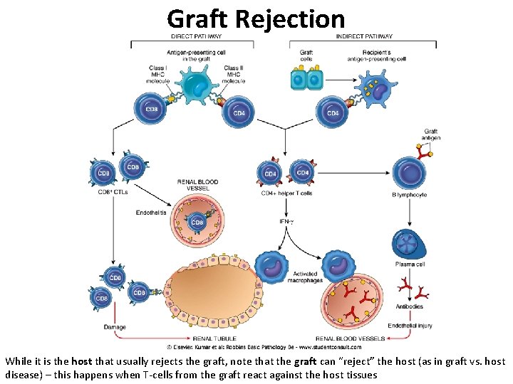 Graft Rejection While it is the host that usually rejects the graft, note that Graft Rejection While it is the host that usually rejects the graft, note that