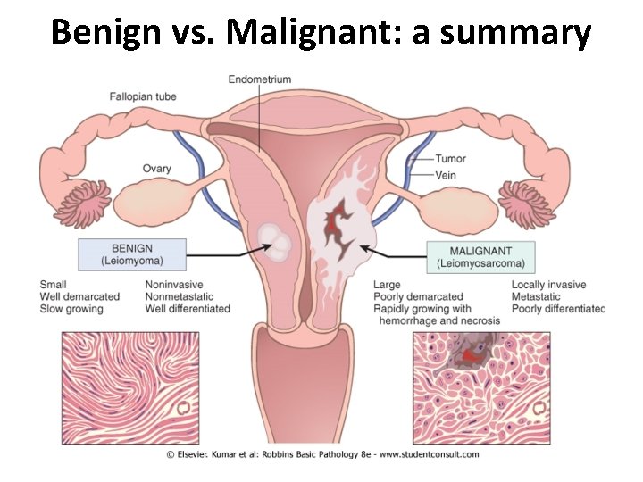 Benign vs. Malignant: a summary Benign vs. Malignant: a summary
