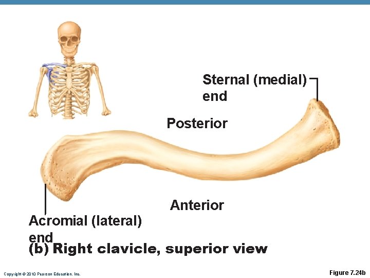 Sternal (medial) end Posterior Anterior Acromial (lateral) end (b) Right clavicle, superior view Copyright Sternal (medial) end Posterior Anterior Acromial (lateral) end (b) Right clavicle, superior view Copyright