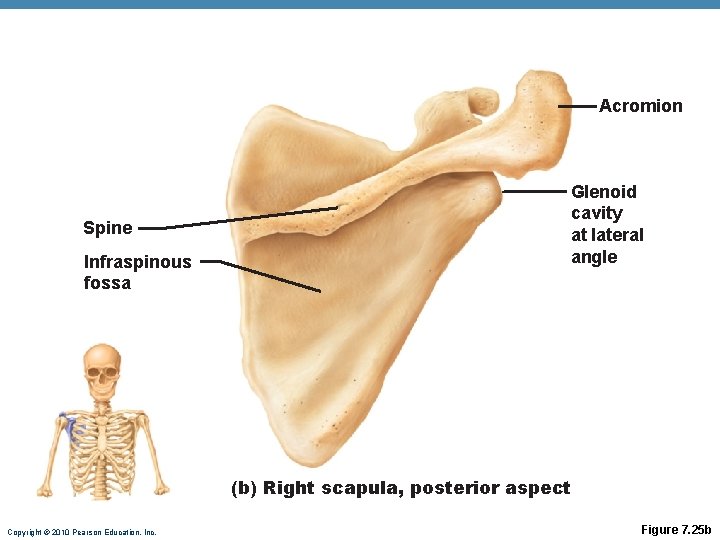 Acromion Spine Infraspinous fossa Glenoid cavity at lateral angle (b) Right scapula, posterior aspect Acromion Spine Infraspinous fossa Glenoid cavity at lateral angle (b) Right scapula, posterior aspect