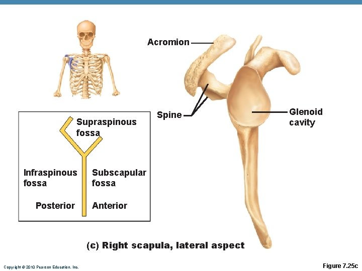 Acromion Supraspinous fossa Infraspinous fossa Posterior Spine Glenoid cavity Subscapular fossa Anterior (c) Right Acromion Supraspinous fossa Infraspinous fossa Posterior Spine Glenoid cavity Subscapular fossa Anterior (c) Right