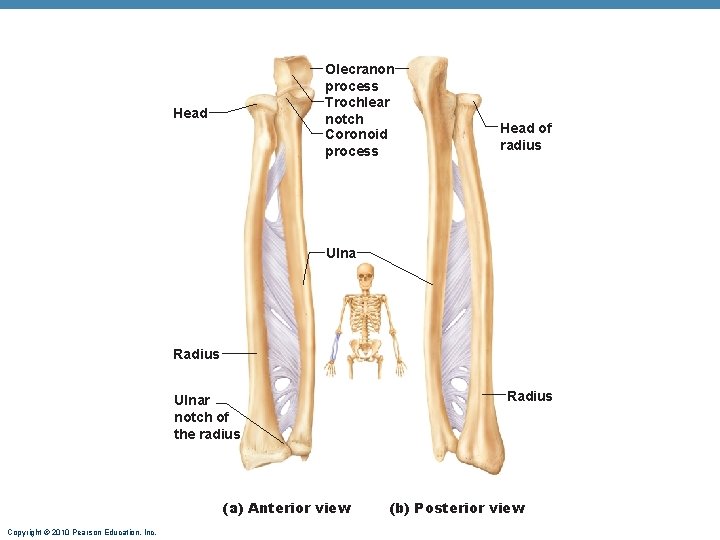 Olecranon process Trochlear notch Coronoid process Head of radius Ulna Radius Ulnar notch of Olecranon process Trochlear notch Coronoid process Head of radius Ulna Radius Ulnar notch of