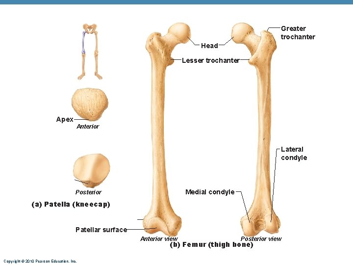 Greater trochanter Head Lesser trochanter Apex Anterior Lateral condyle Medial condyle Posterior (a) Patella Greater trochanter Head Lesser trochanter Apex Anterior Lateral condyle Medial condyle Posterior (a) Patella