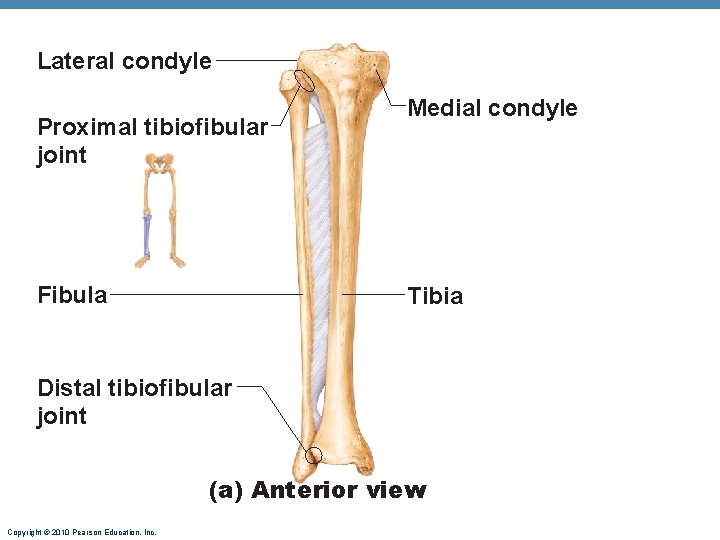 Lateral condyle Proximal tibiofibular joint Fibula Medial condyle Tibia Distal tibiofibular joint (a) Anterior Lateral condyle Proximal tibiofibular joint Fibula Medial condyle Tibia Distal tibiofibular joint (a) Anterior