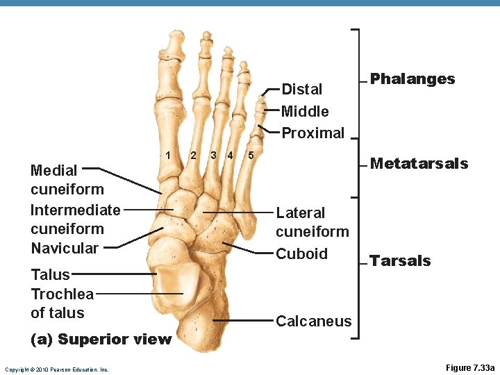 Distal Middle Proximal 1 Medial cuneiform Intermediate cuneiform Navicular Talus Trochlea of talus (a) Distal Middle Proximal 1 Medial cuneiform Intermediate cuneiform Navicular Talus Trochlea of talus (a)