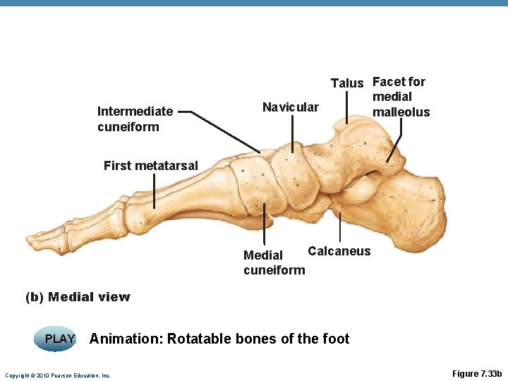 Intermediate cuneiform Talus Facet for medial Navicular malleolus First metatarsal Calcaneus Medial cuneiform (b) Intermediate cuneiform Talus Facet for medial Navicular malleolus First metatarsal Calcaneus Medial cuneiform (b)