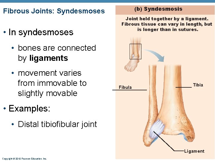 (b) Syndesmosis Fibrous Joints: Syndesmoses • In syndesmoses Joint held together by a ligament. (b) Syndesmosis Fibrous Joints: Syndesmoses • In syndesmoses Joint held together by a ligament.