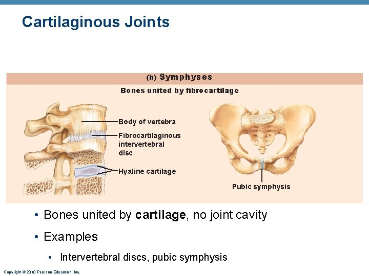 Cartilaginous Joints (b) Symphyses Bones united by fibrocartilage Body of vertebra Fibrocartilaginous intervertebral disc Cartilaginous Joints (b) Symphyses Bones united by fibrocartilage Body of vertebra Fibrocartilaginous intervertebral disc