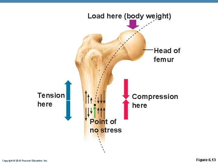 Load here (body weight) Head of femur Tension here Compression here Point of no Load here (body weight) Head of femur Tension here Compression here Point of no