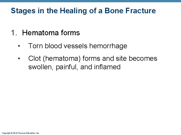 Stages in the Healing of a Bone Fracture 1. Hematoma forms • Torn blood Stages in the Healing of a Bone Fracture 1. Hematoma forms • Torn blood