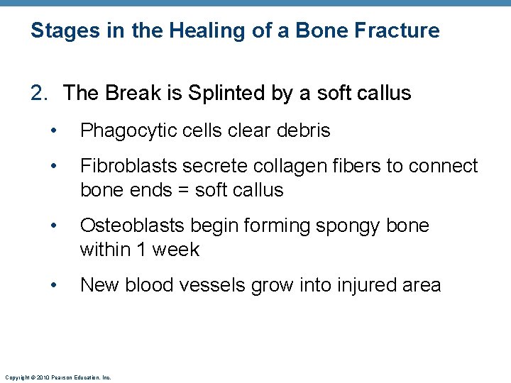 Stages in the Healing of a Bone Fracture 2. The Break is Splinted by Stages in the Healing of a Bone Fracture 2. The Break is Splinted by