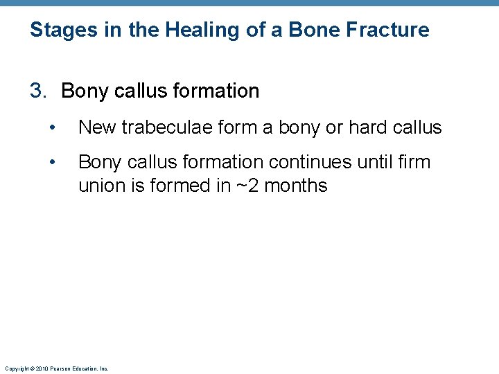 Stages in the Healing of a Bone Fracture 3. Bony callus formation • New Stages in the Healing of a Bone Fracture 3. Bony callus formation • New