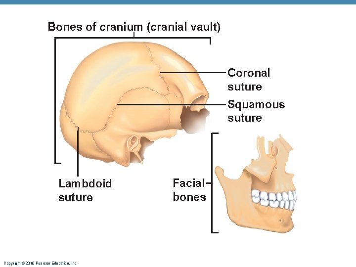 Bones of cranium (cranial vault) Coronal suture Squamous suture Lambdoid suture Copyright © 2010 Bones of cranium (cranial vault) Coronal suture Squamous suture Lambdoid suture Copyright © 2010