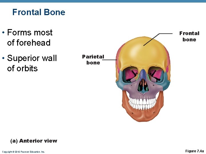 Frontal Bone • Forms most of forehead • Superior wall of orbits Frontal bone Frontal Bone • Forms most of forehead • Superior wall of orbits Frontal bone