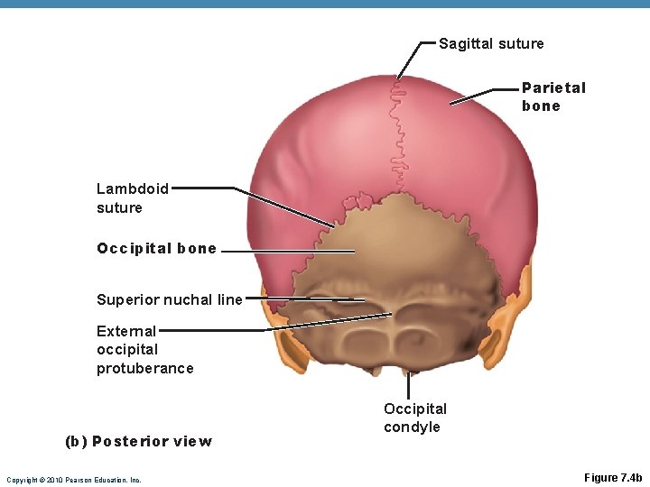Sagittal suture Parietal bone Lambdoid suture Occipital bone Superior nuchal line External occipital protuberance Sagittal suture Parietal bone Lambdoid suture Occipital bone Superior nuchal line External occipital protuberance