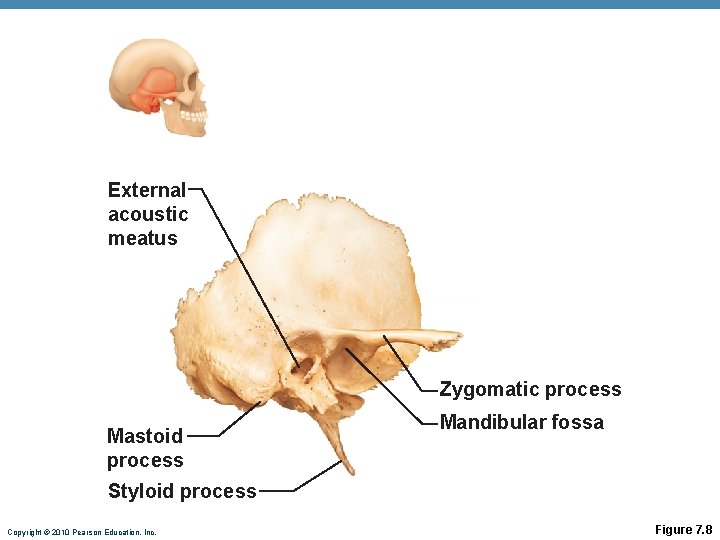 External acoustic meatus Zygomatic process Mastoid process Mandibular fossa Styloid process Copyright © 2010 External acoustic meatus Zygomatic process Mastoid process Mandibular fossa Styloid process Copyright © 2010