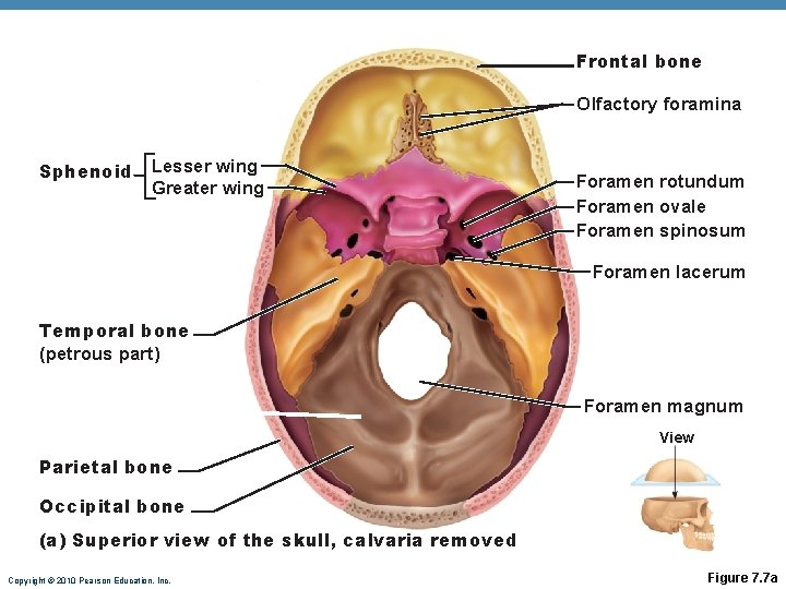 Frontal bone Olfactory foramina Sphenoid Lesser wing Greater wing Foramen rotundum Foramen ovale Foramen Frontal bone Olfactory foramina Sphenoid Lesser wing Greater wing Foramen rotundum Foramen ovale Foramen