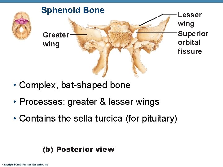 Sphenoid Bone Greater wing • Complex, bat-shaped bone • Processes: greater & lesser wings Sphenoid Bone Greater wing • Complex, bat-shaped bone • Processes: greater & lesser wings