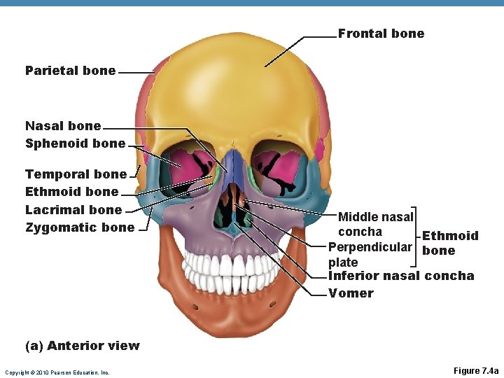 Frontal bone Parietal bone Nasal bone Sphenoid bone Temporal bone Ethmoid bone Lacrimal bone Frontal bone Parietal bone Nasal bone Sphenoid bone Temporal bone Ethmoid bone Lacrimal bone