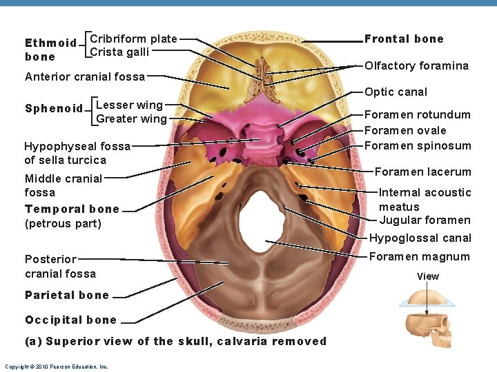 Ethmoid bone Cribriform plate Crista galli Anterior cranial fossa Sphenoid Lesser wing Greater wing Ethmoid bone Cribriform plate Crista galli Anterior cranial fossa Sphenoid Lesser wing Greater wing