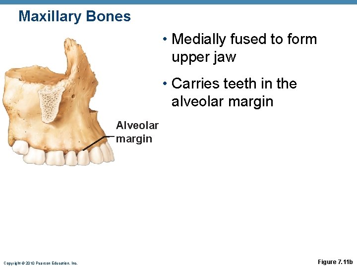 Maxillary Bones • Medially fused to form upper jaw • Carries teeth in the Maxillary Bones • Medially fused to form upper jaw • Carries teeth in the
