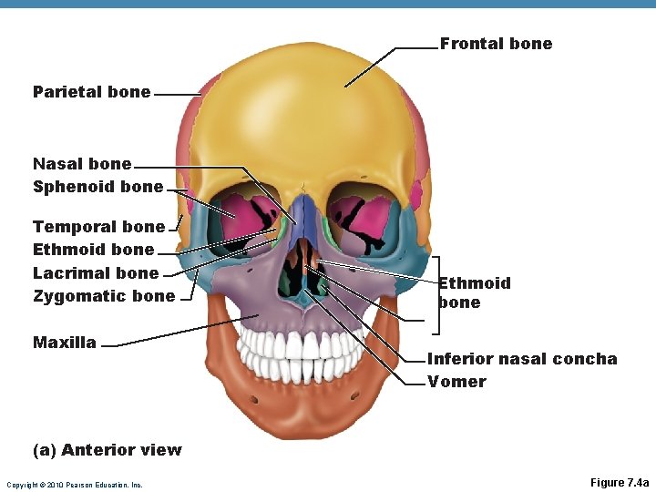 Frontal bone Parietal bone Nasal bone Sphenoid bone Temporal bone Ethmoid bone Lacrimal bone Frontal bone Parietal bone Nasal bone Sphenoid bone Temporal bone Ethmoid bone Lacrimal bone